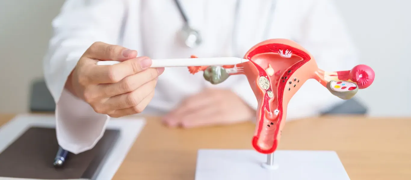 Endometrioza: de ce diagnosticul corect schimbă complet parcursul pacientei