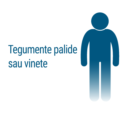 Tegumente palide sau vinete