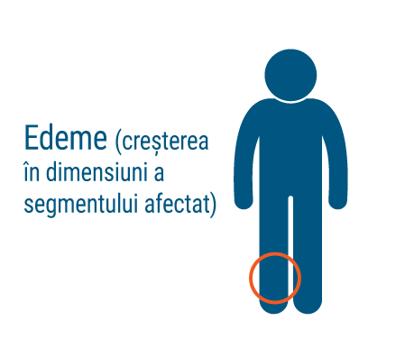 Edeme, simptome stenoze de artere periferice