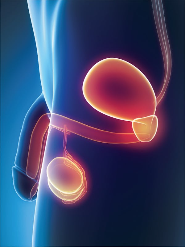 Adenomul de prostată - cauze, simptome, tratament
