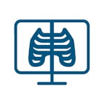 Vei efectua o radiografie toracică