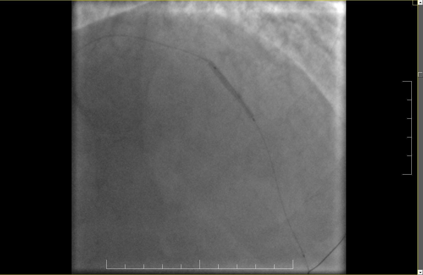 Scintigrafie | Spitalele ARES