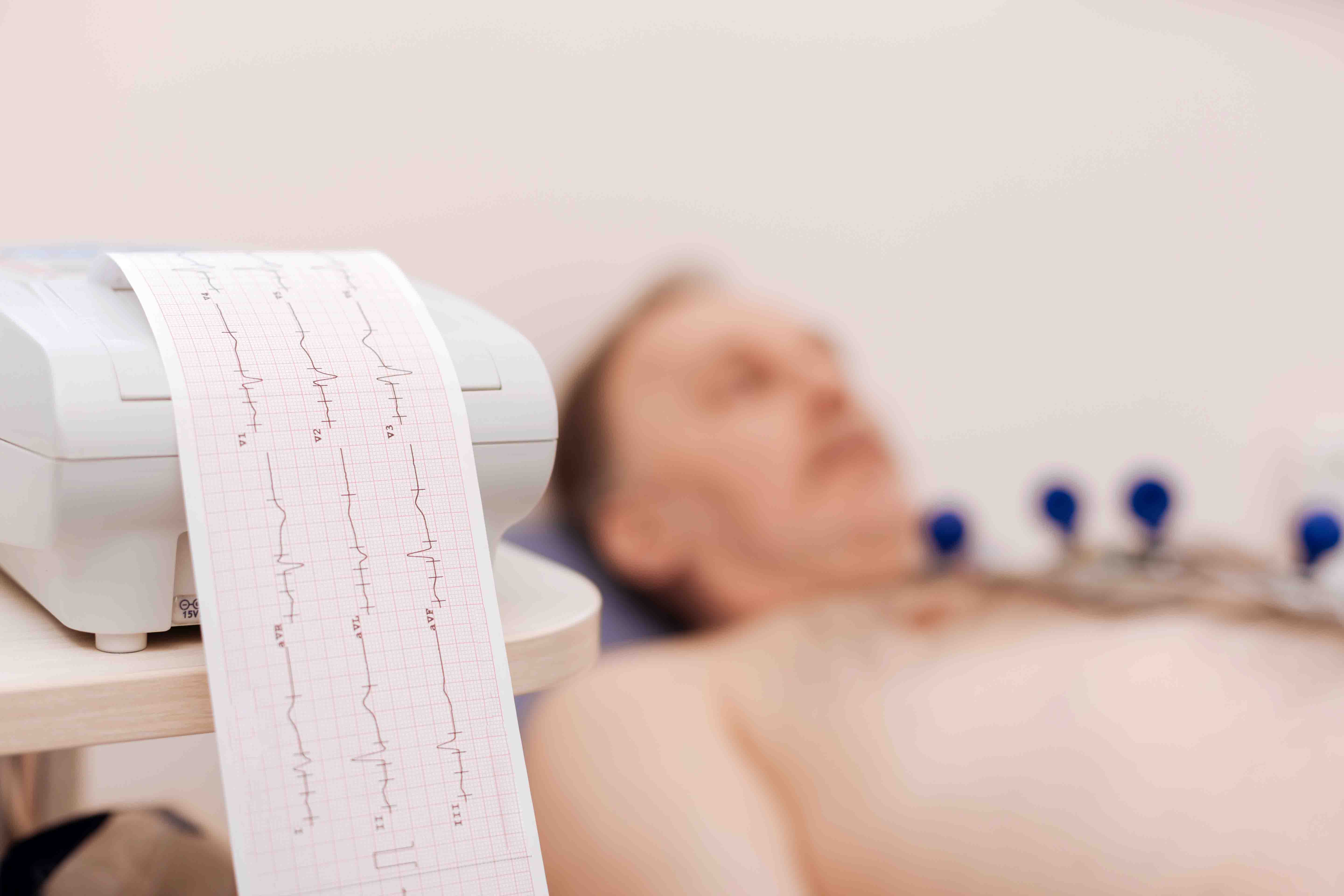 Electrocardiograma - ECG / EKG | MONZA ARES