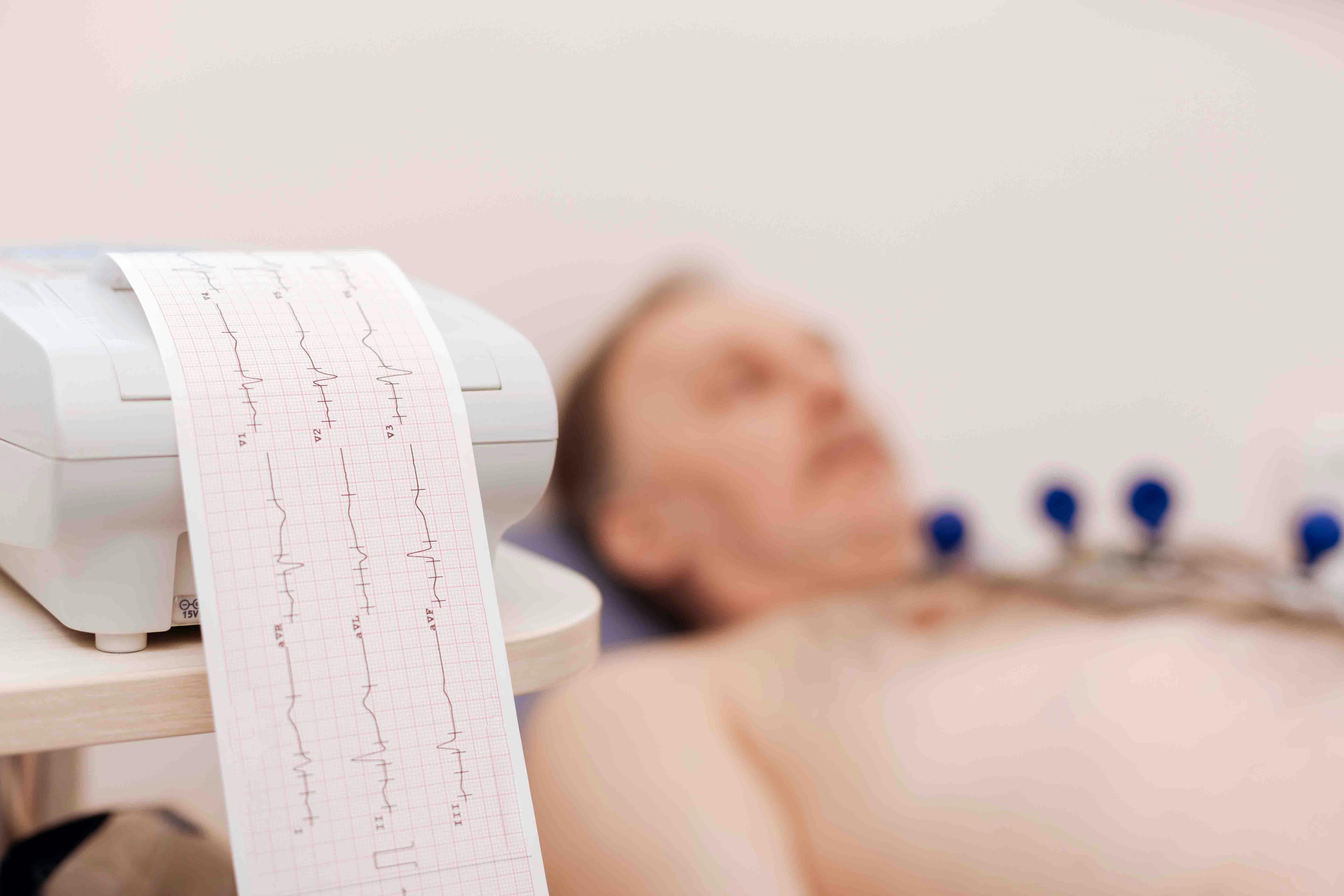 Electrocardiograma