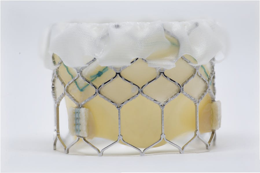 TAVI: Încă opt pacienți pot beneficia de TAVI gratuit