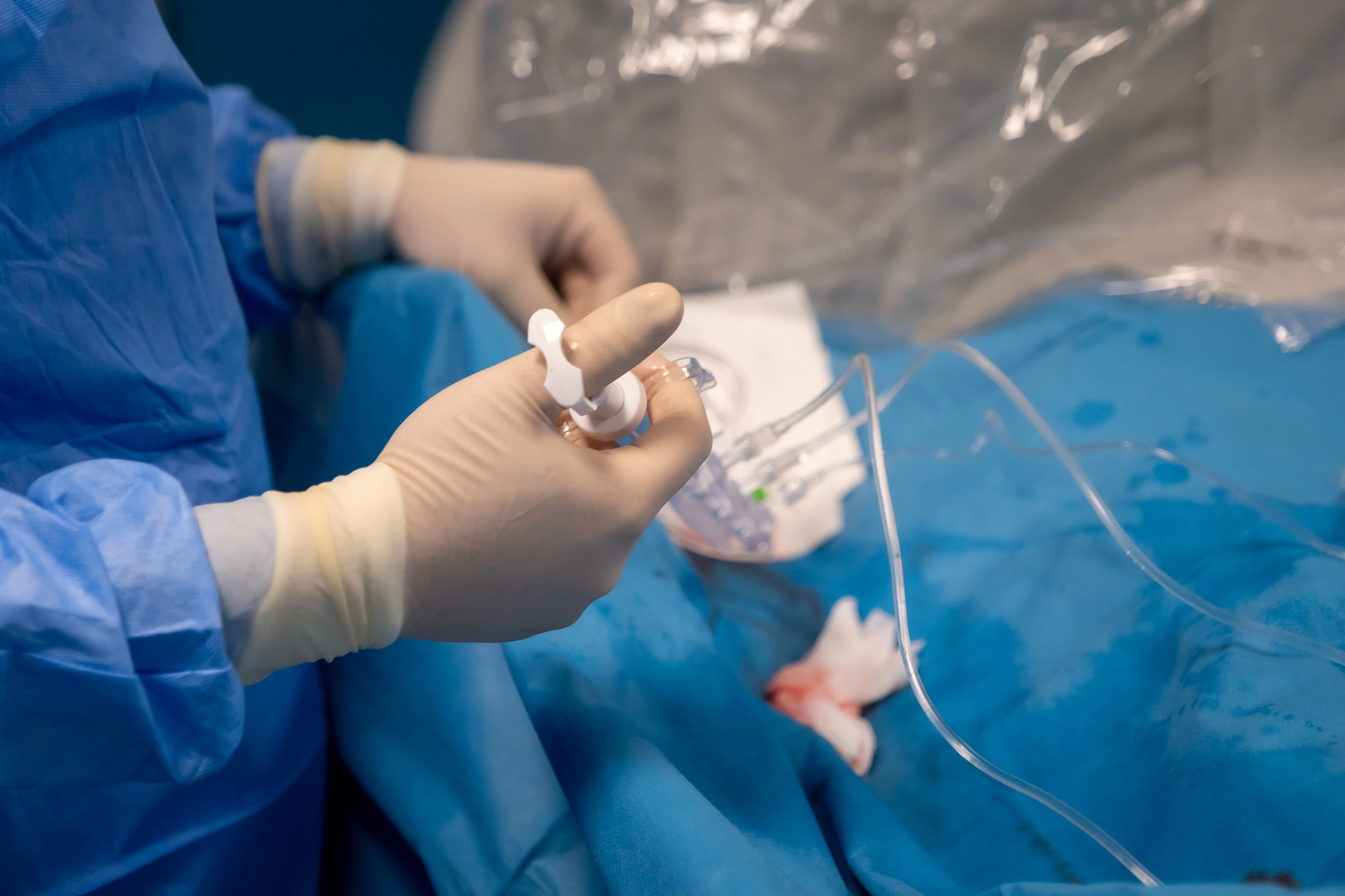 Angioplastie coronariană cu implantarea a două stenturi pentru tratamentul stenozelor coronariene

