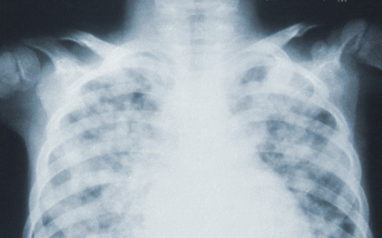 X-ray skeleton
