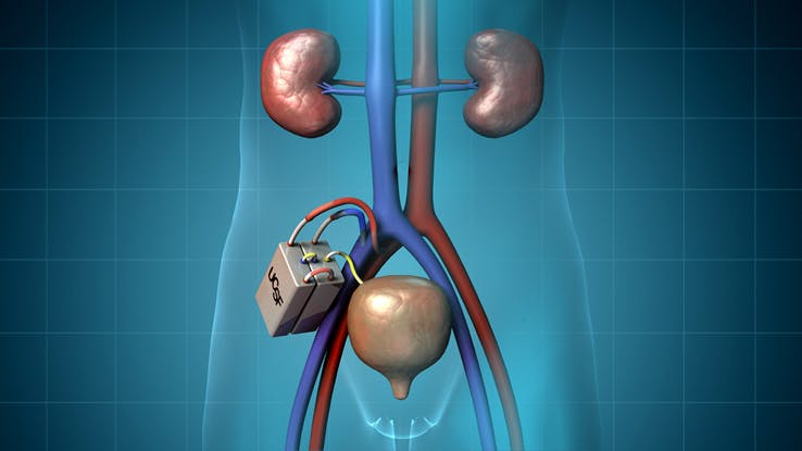 Image: The Kidney Project, UCSF & VUMC