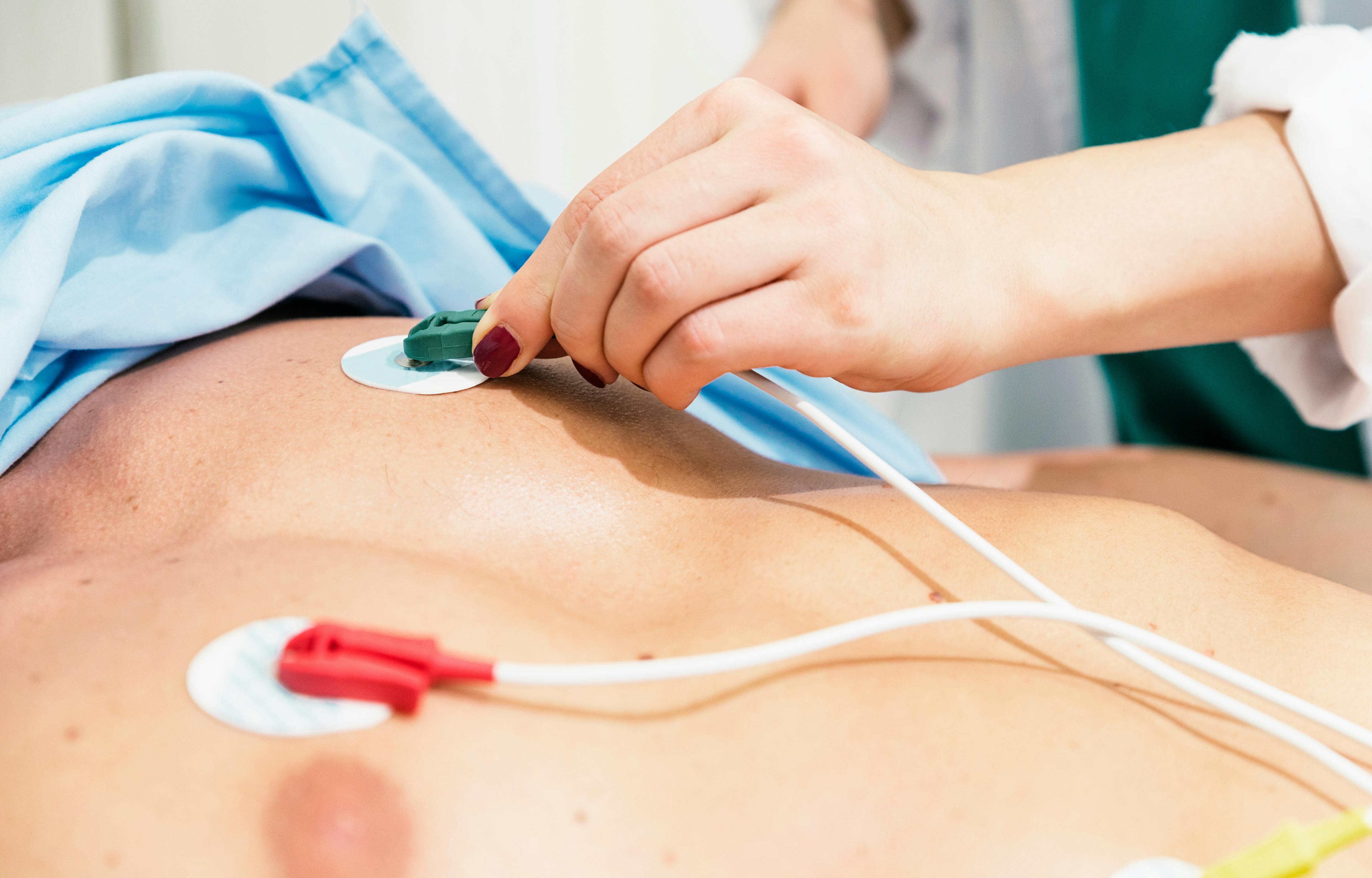 lung cancer tumor zapper
