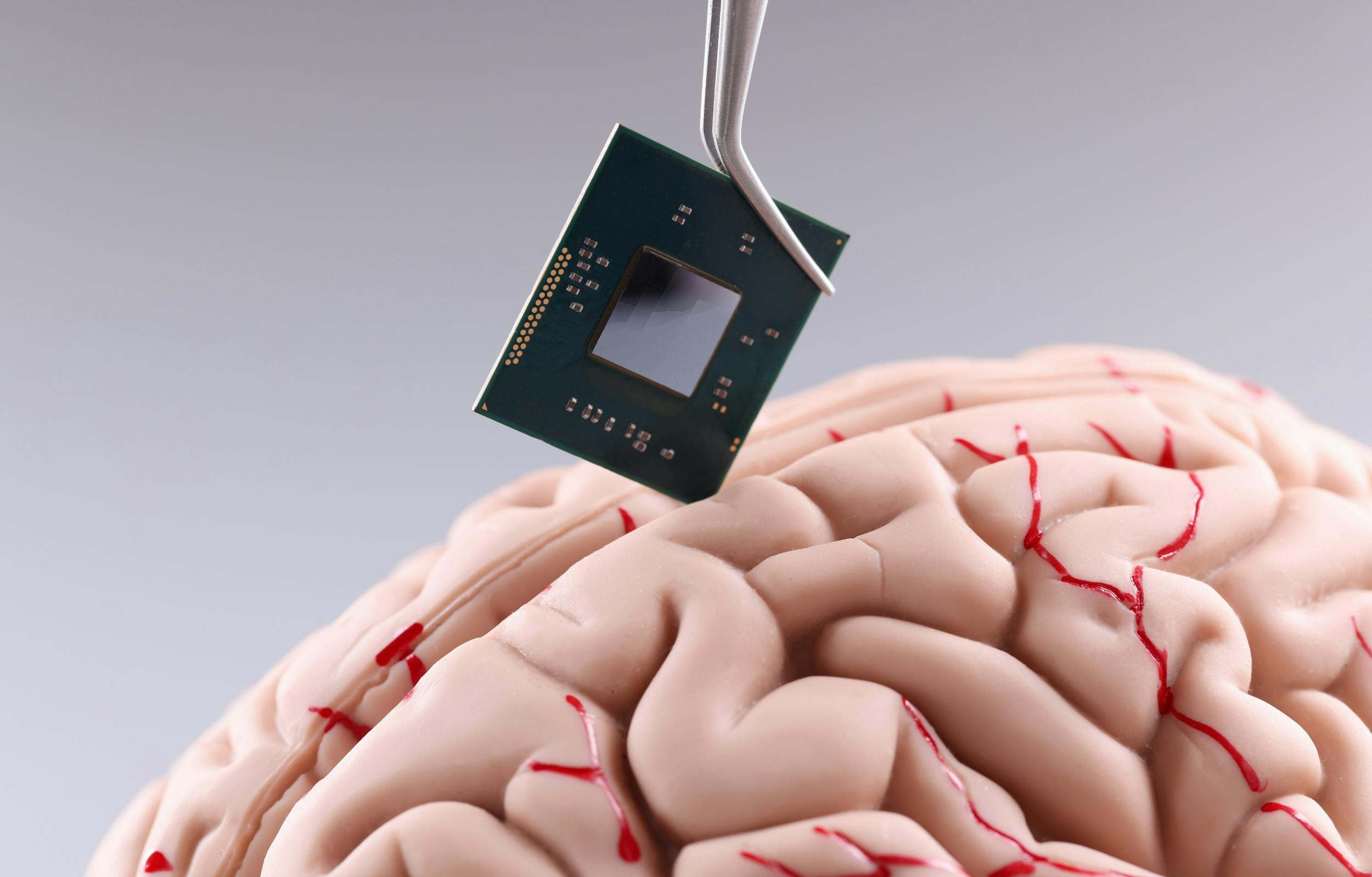 brain-computer interface technology