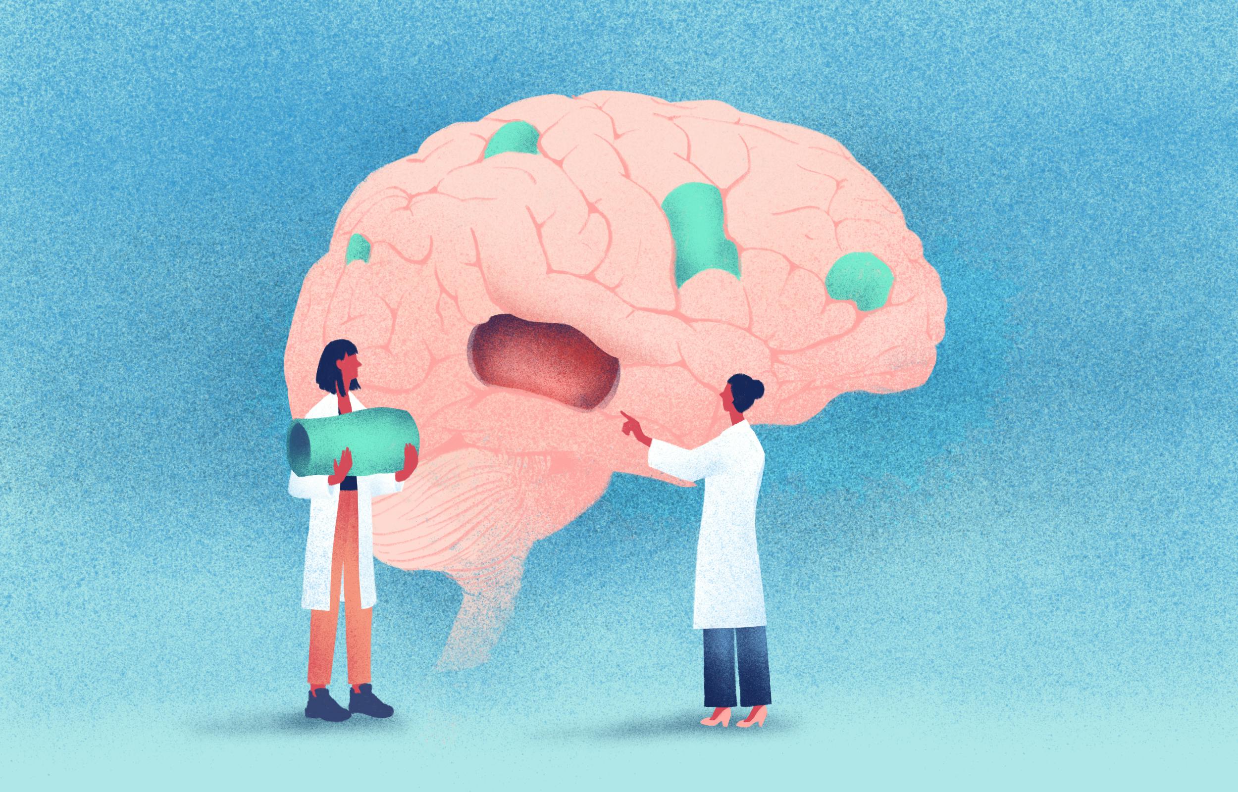 brain tissue replacement