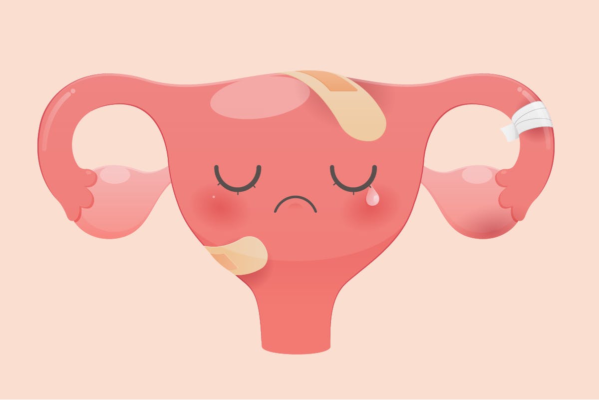 hpv treatment leep viermi ce medicament să bea
