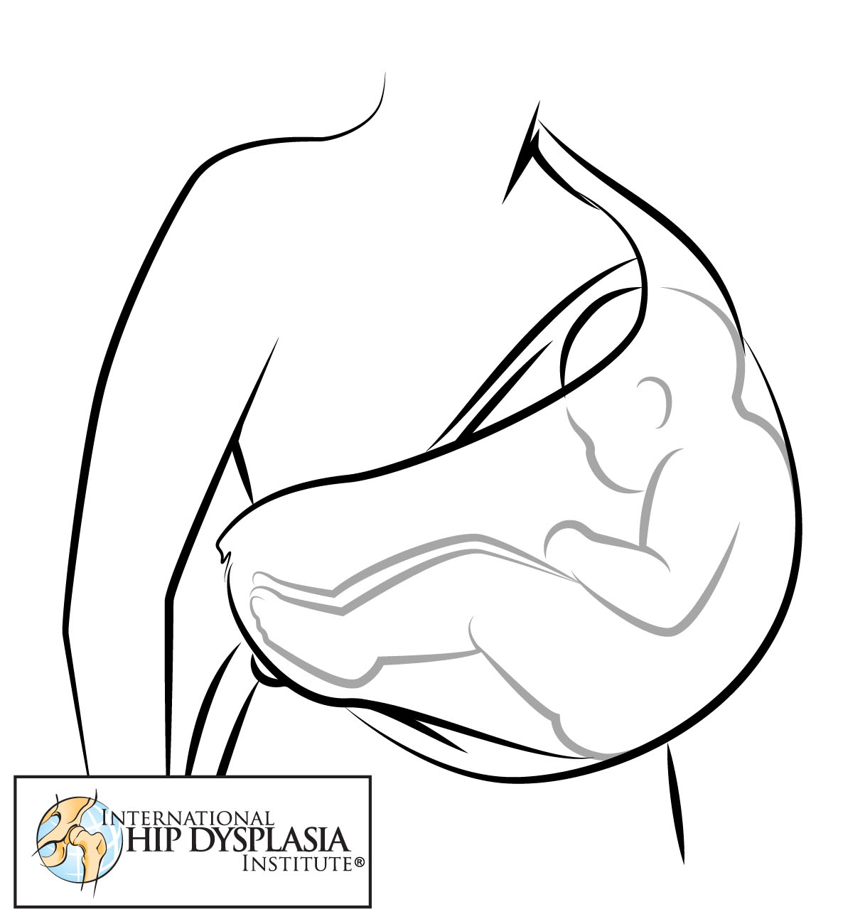 baby sling hip dysplasia