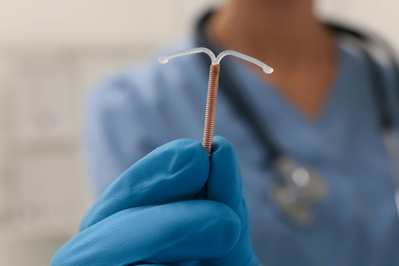 Paragard copper IUD representing the Paragard adverse events with growing litigation.