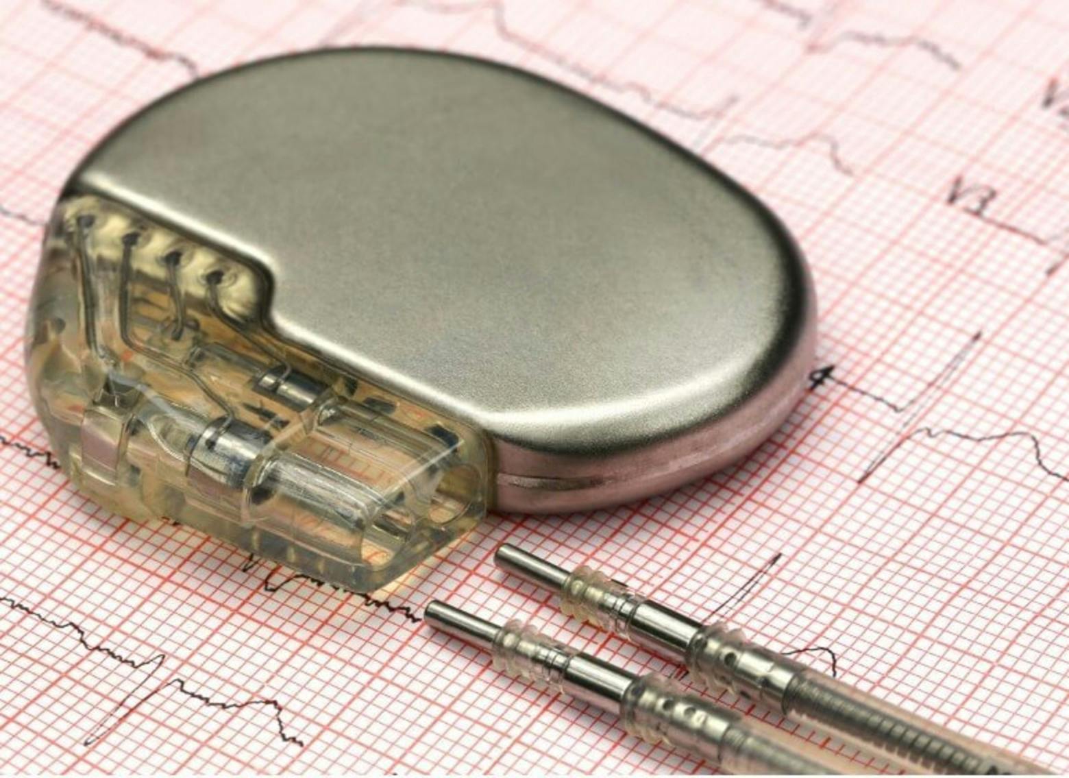 FDA Alert Indicates Some Medtronic Pacemaker Batteries Can Fail Without ...