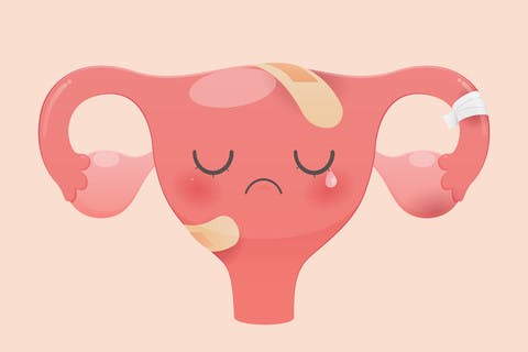 hpv leep kúra enterobius vermicularis nemzetség