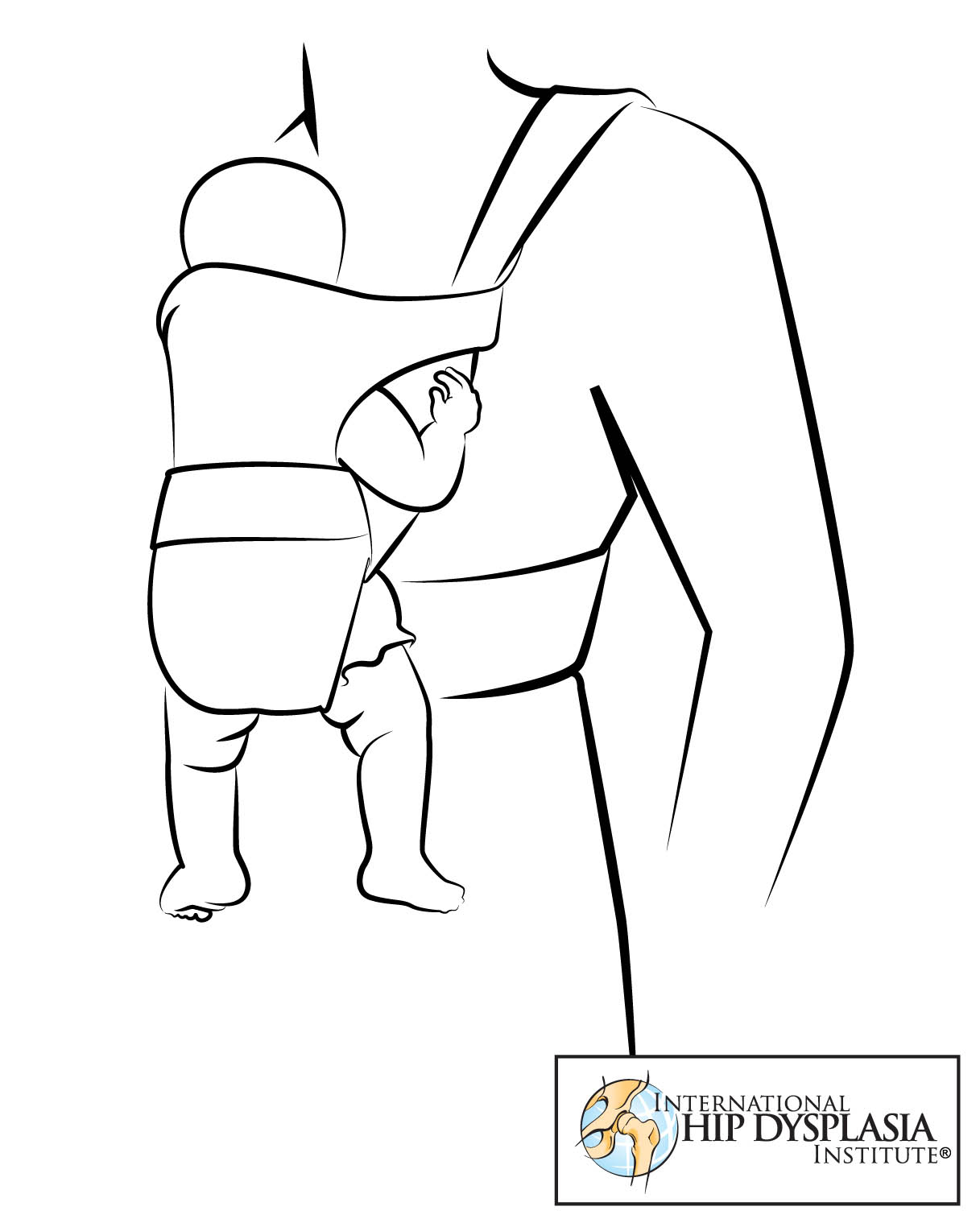 baby carriers that cause hip dysplasia