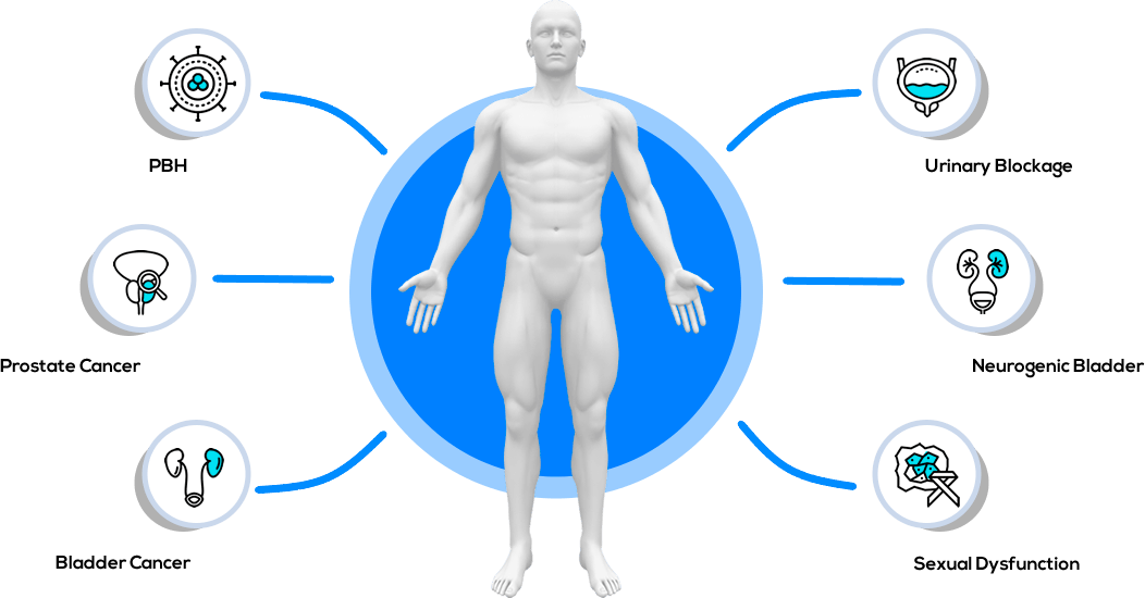 What is a uroflow