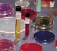 PLASMA COAGULASA CON EDTA 10X3ML