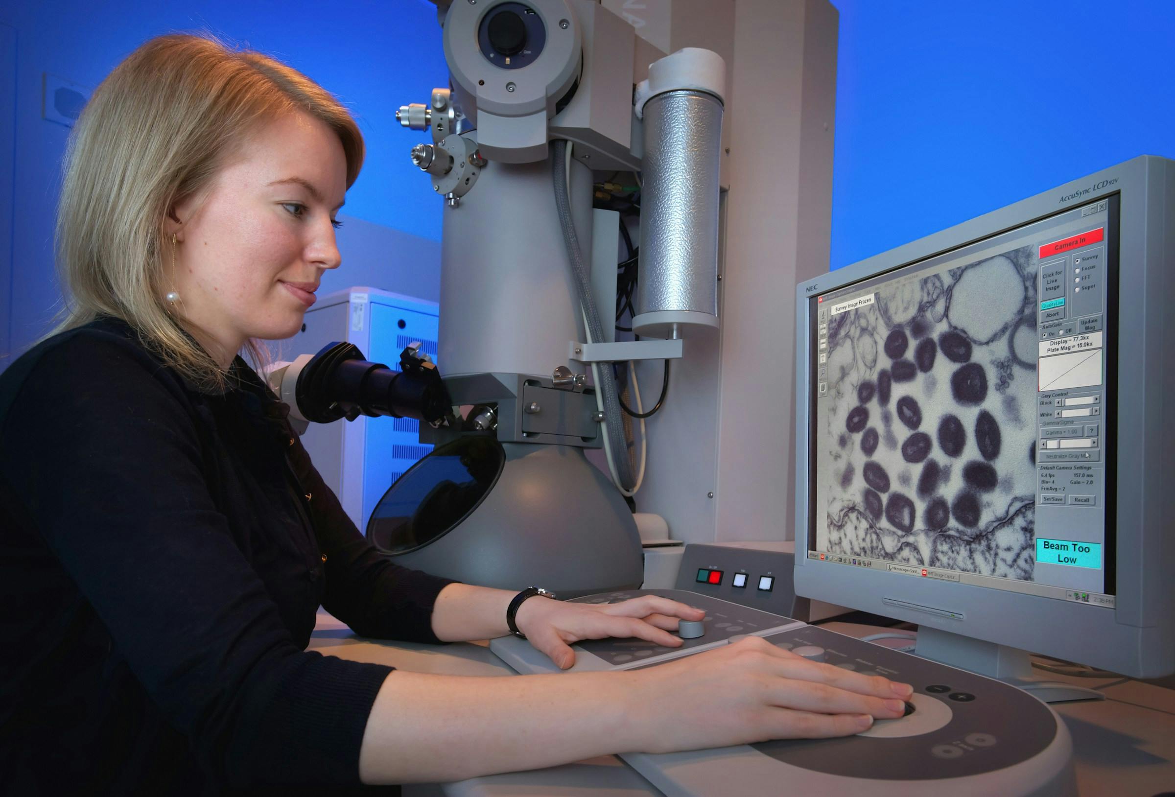 Microscopic view of white blood cells in the bloodstream