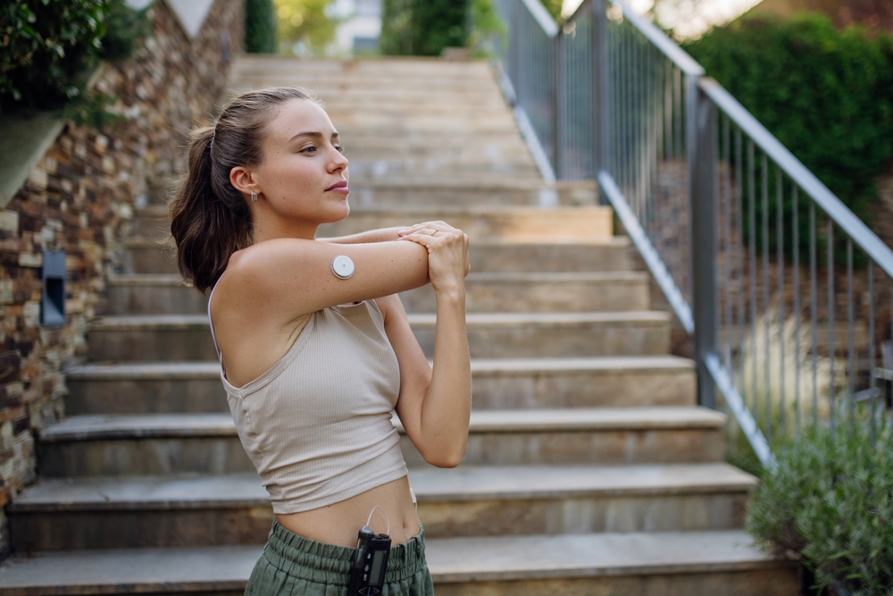 Woman with CGM to monitor her blood glucose while she exercise to lose weight