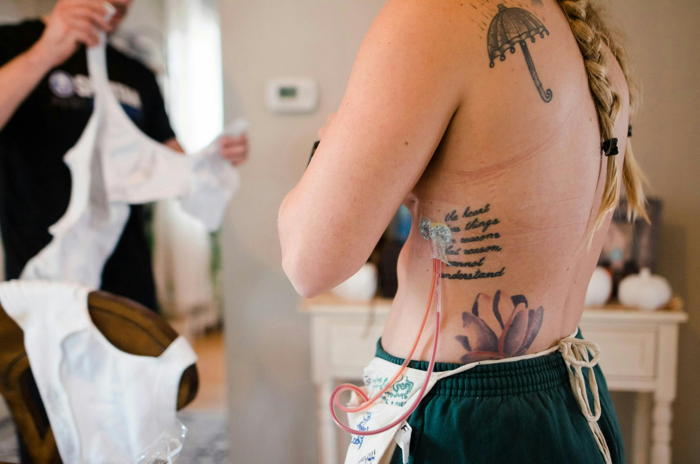 Safe tattooing practices for people with diabetes