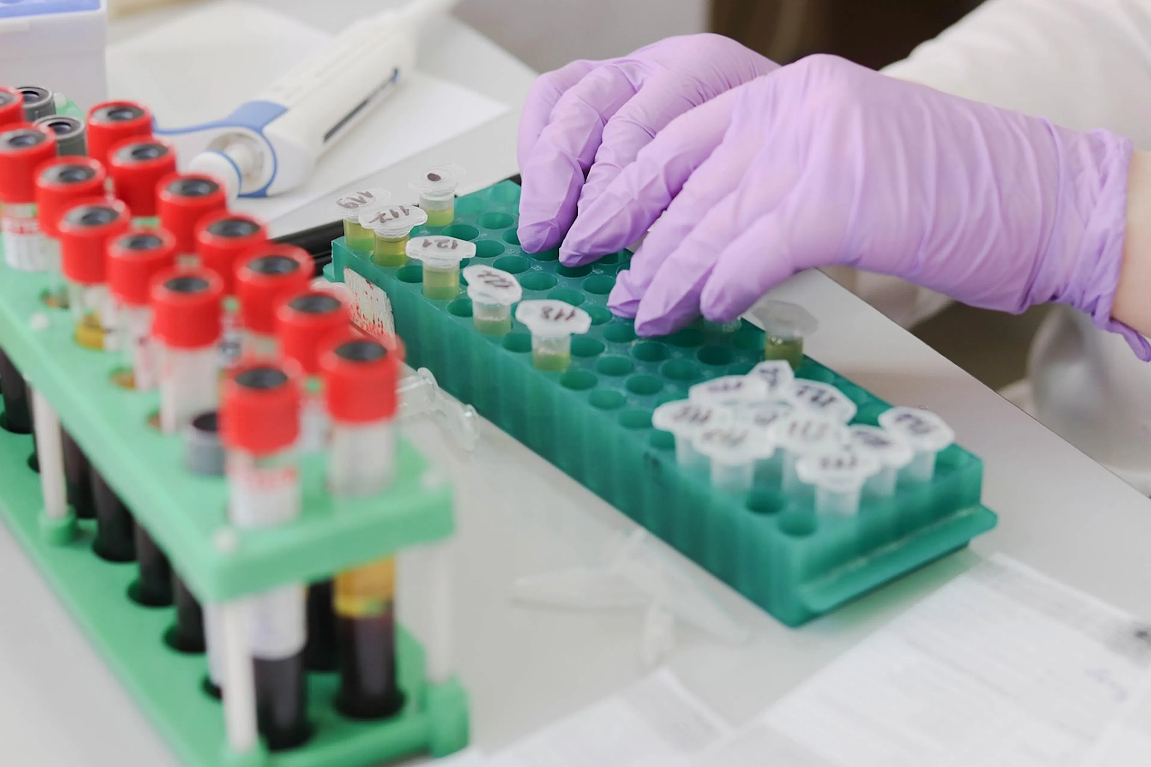 Insulin resistance and HDL cholesterol relationship