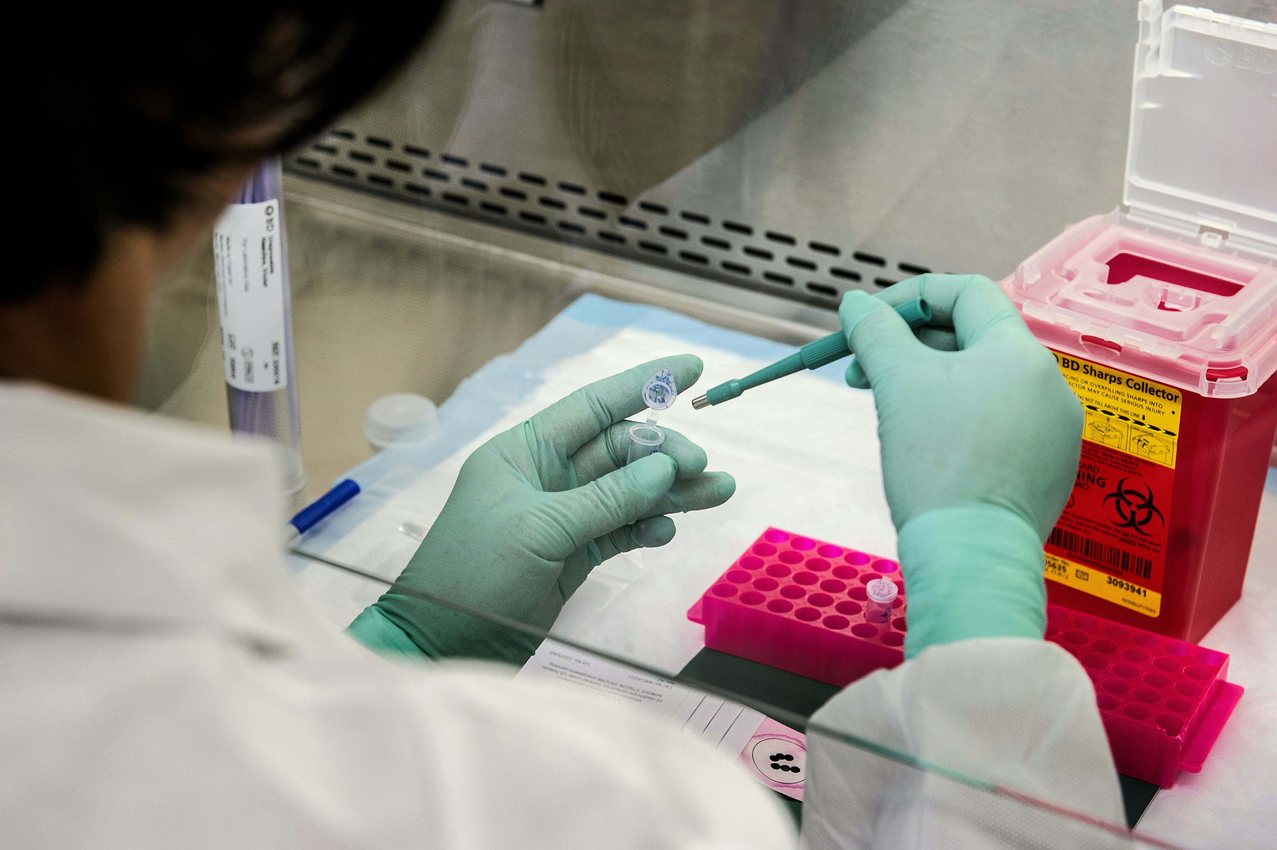 DUTCH test for hormones
