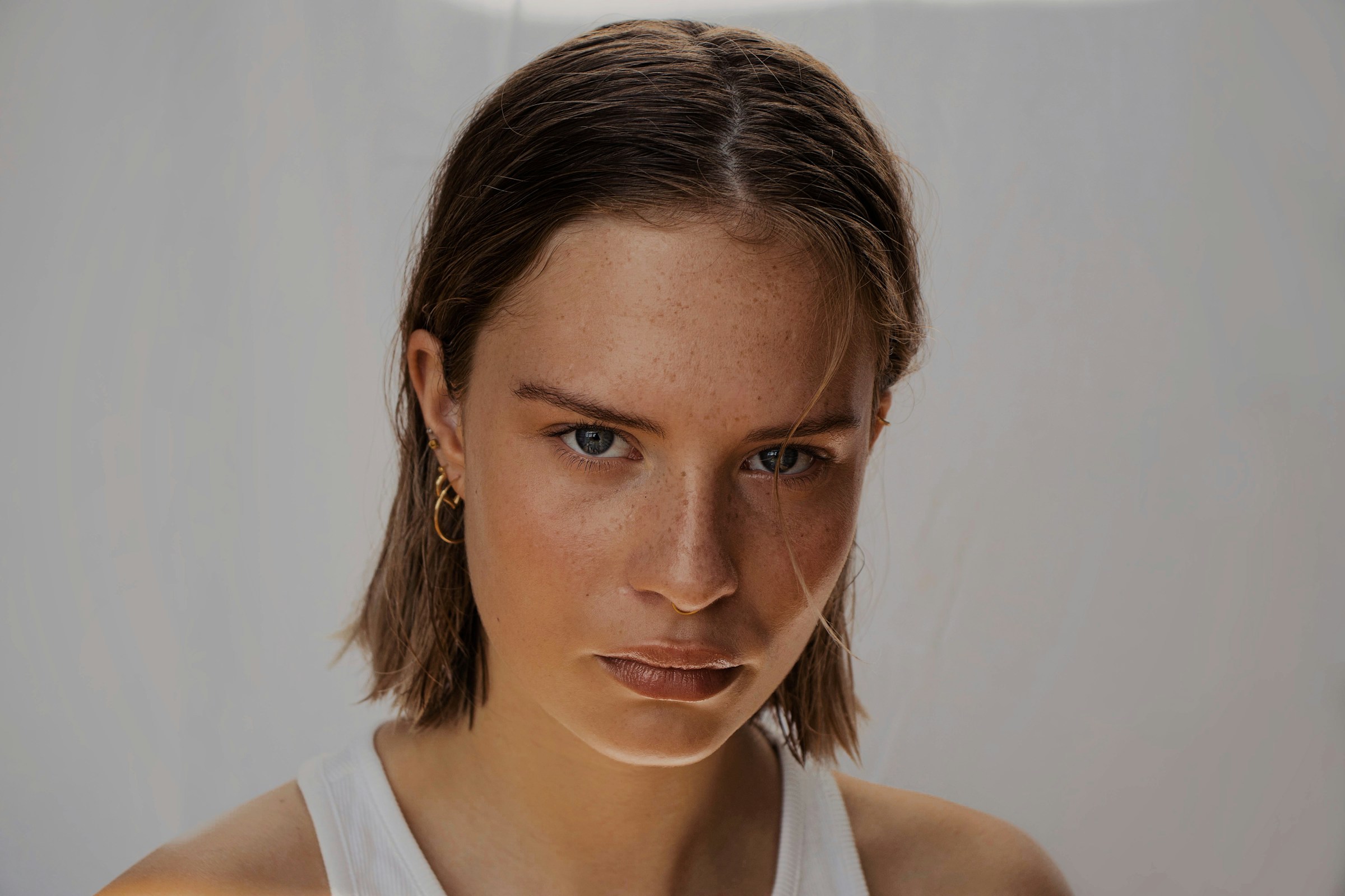 how to treat PCOS acne naturally