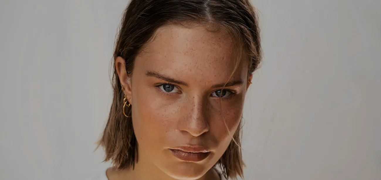 how to treat PCOS acne naturally