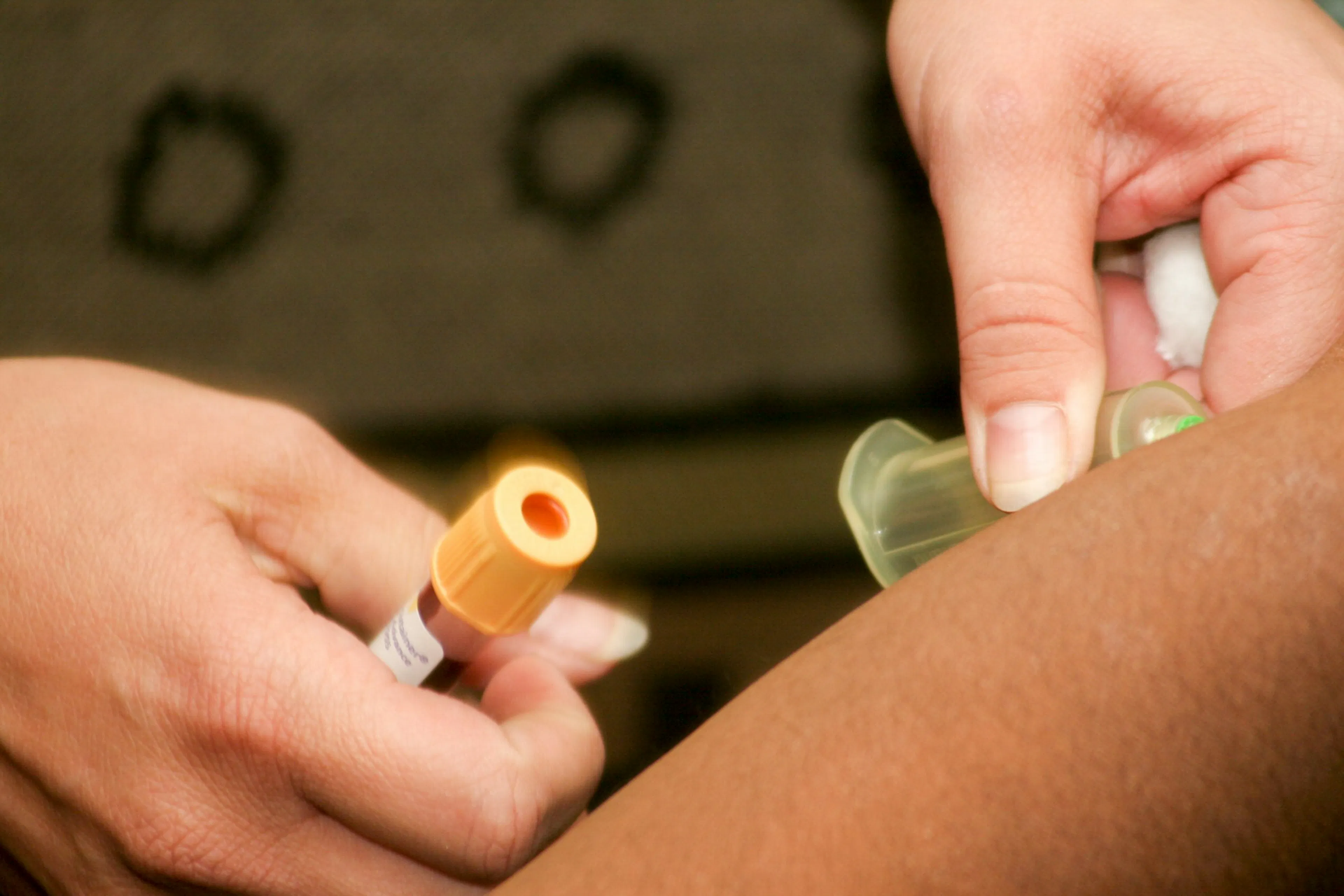 blood work before Ozempic