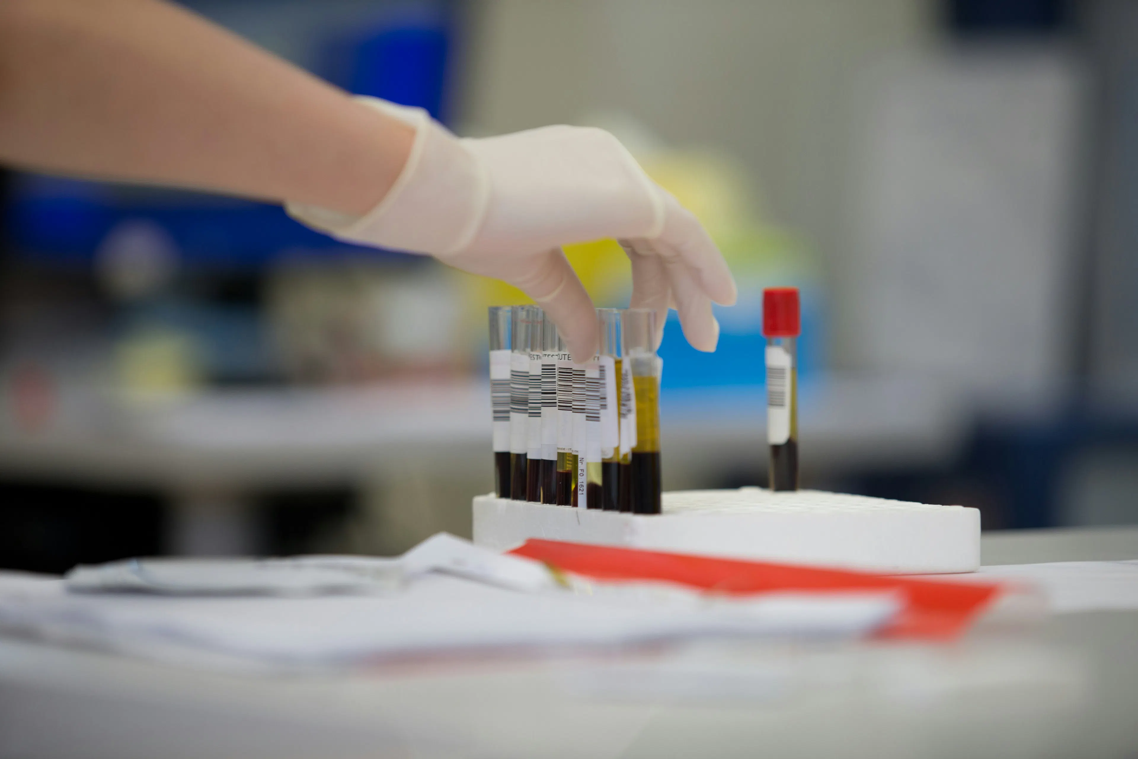 Meto PCOS and Hormonal Health Panel showing biomarkers tested