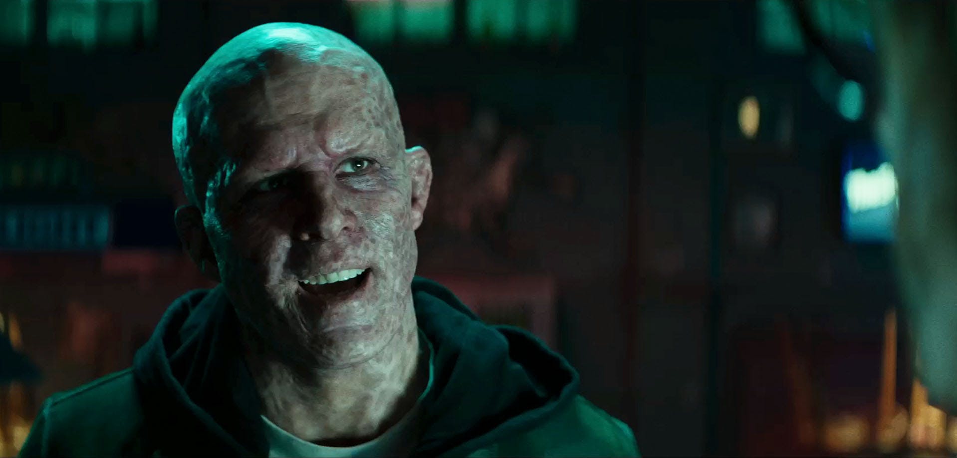 TV30 - Biggest Claim