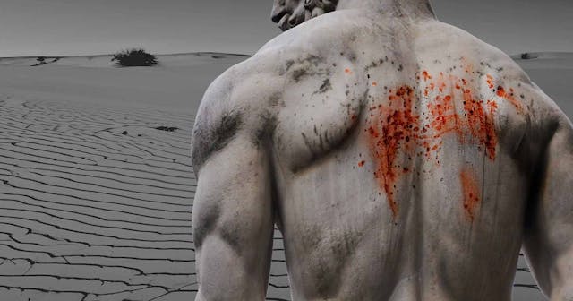 scars