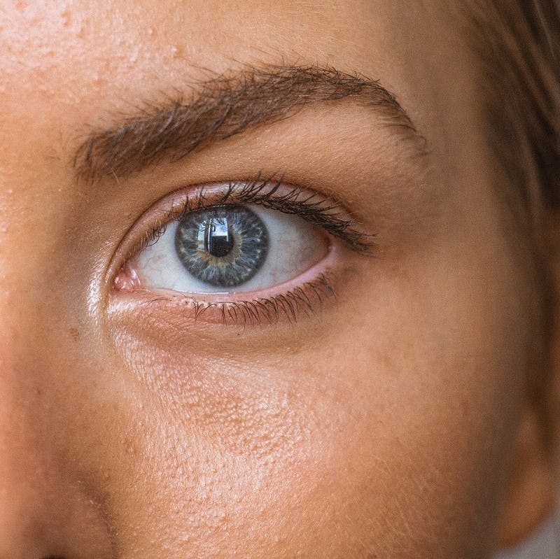 A woman's left eye and her facial area around it, the surface of her skin is greasy.