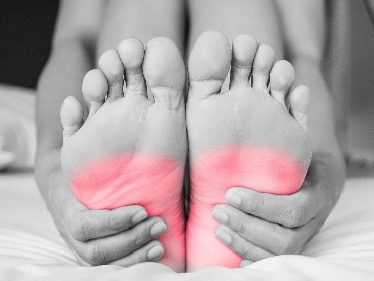 symptoms of plantar fasciitis heel pain