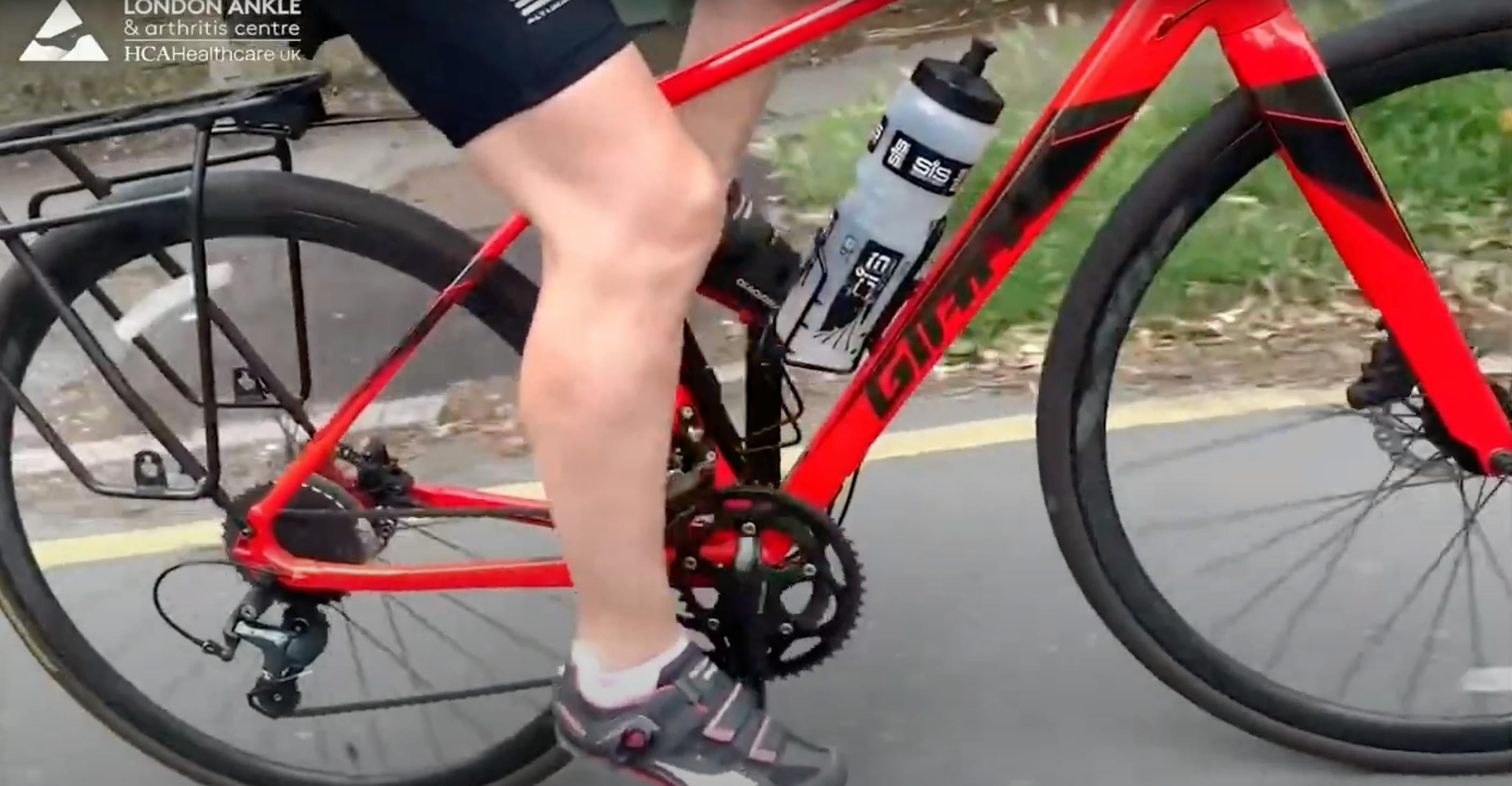 Sport after ankle replacement