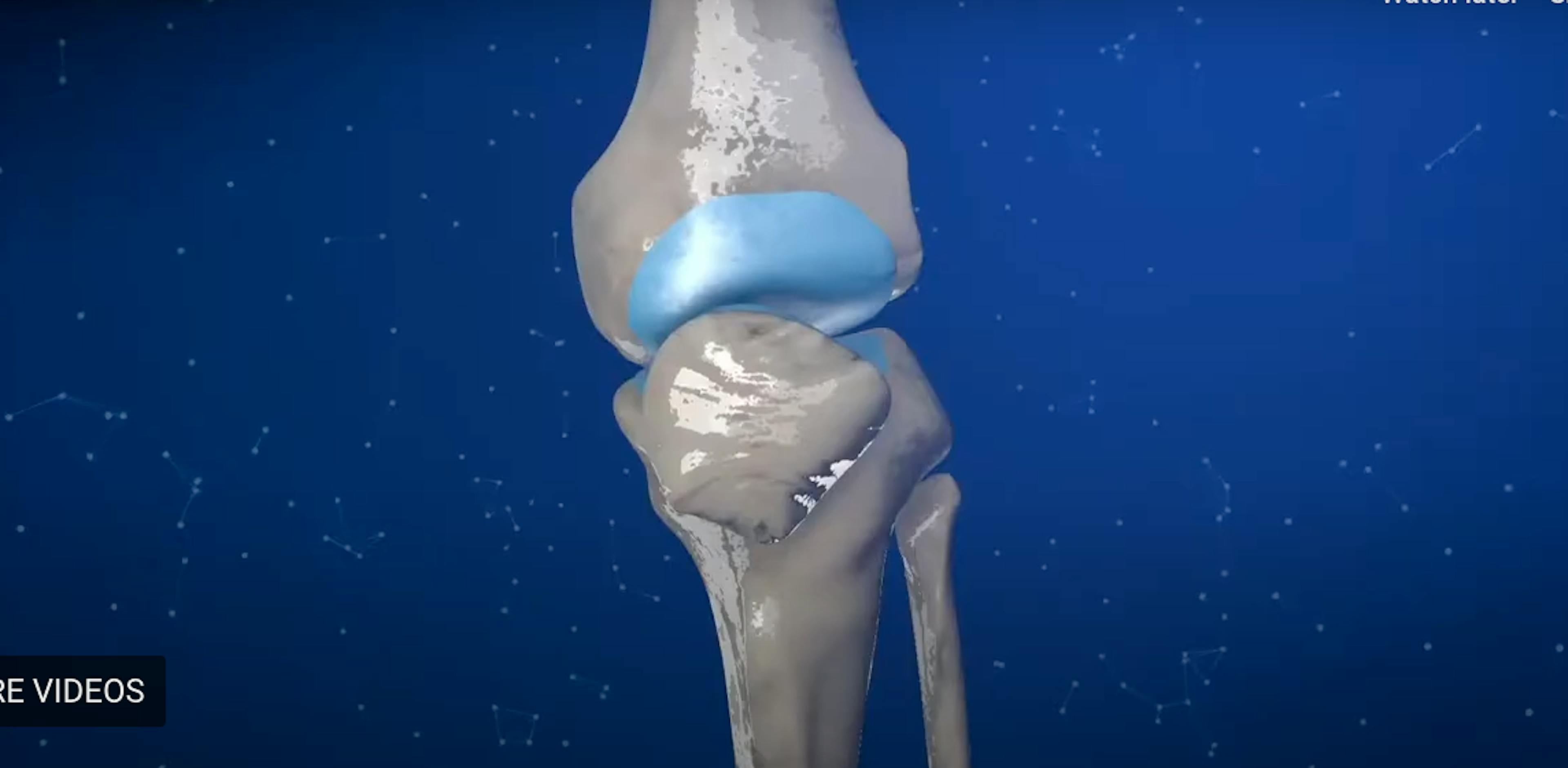 What's the difference between osteoporosis and osteoarthritis?