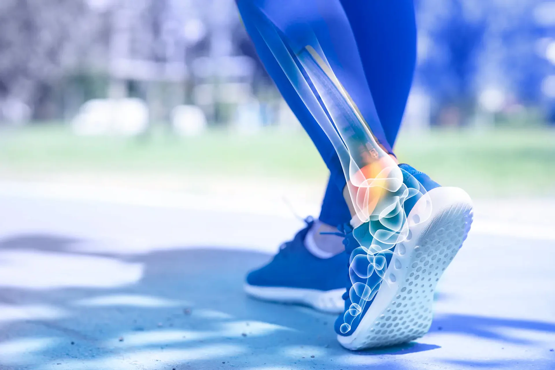 Running injuries