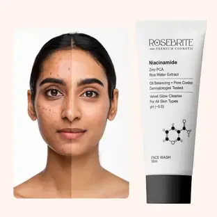 RoseBrite Niacinamide Facewash with Zinc PCA & Rice Water Extract for Clear Skin, Oil Balance & Radiant Brightening Face Wash