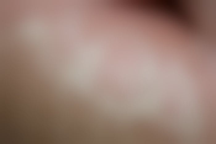 Calluses closeup image