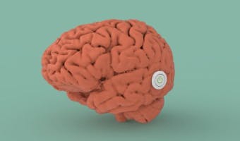 How to Think Like an Investor: Understanding the Actual Cost of Fundraising