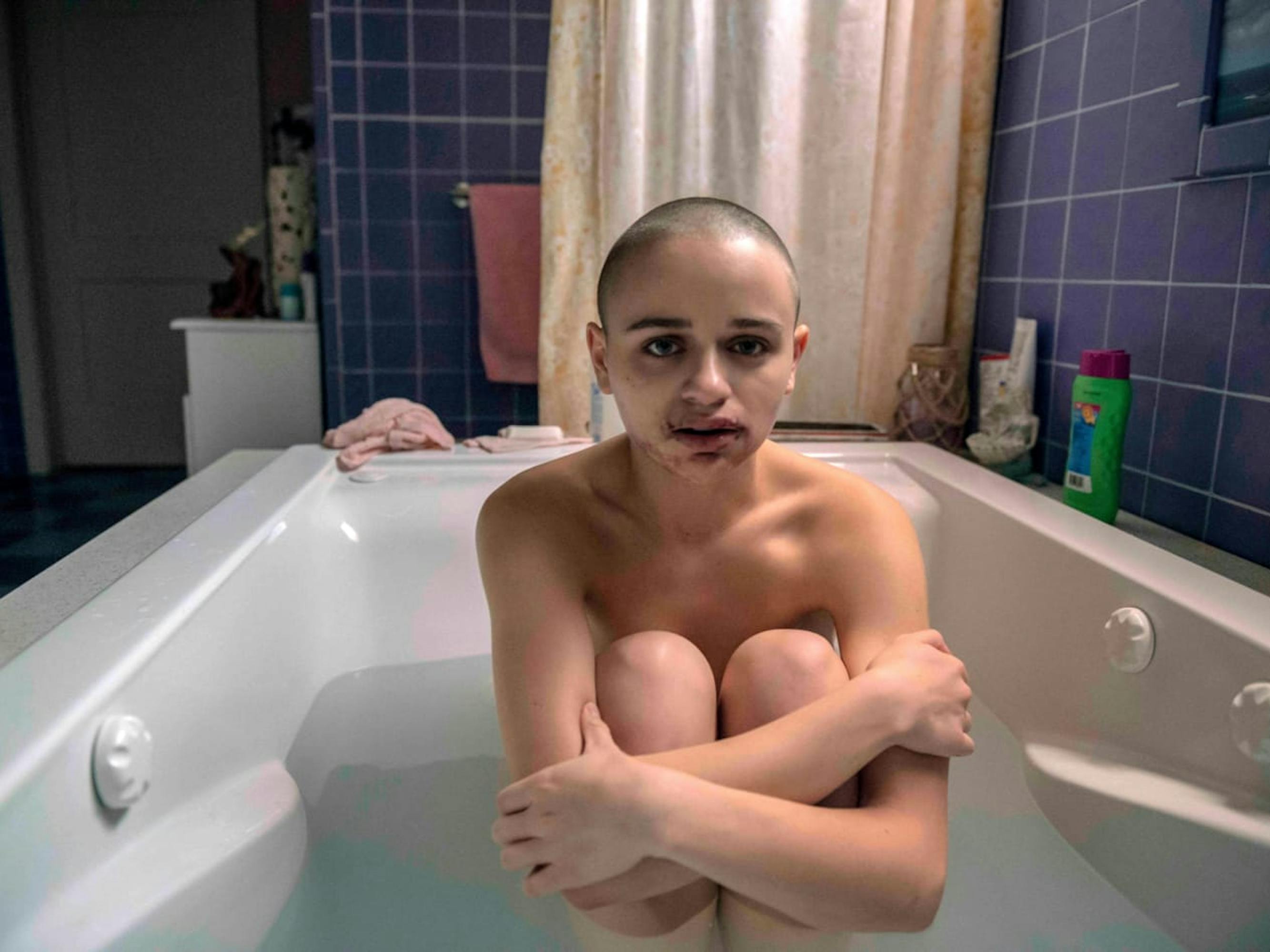 Gypsy Rose Blanchard (Joey King) in The Act sits in the bath, arms wrapped around her legs. The walls are covered in blue tiles, and different bath products scatter the side. Her mouth is bruised and scarred.