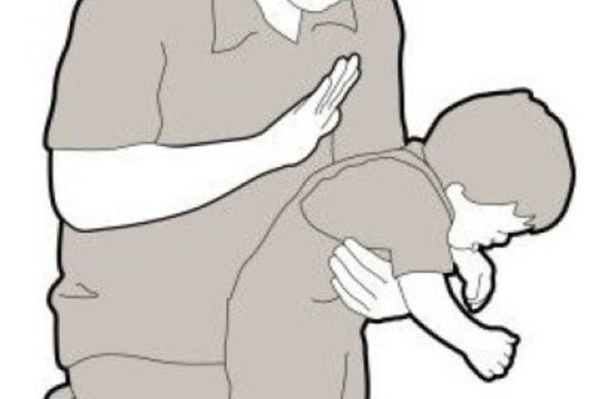 illustration of baby choking