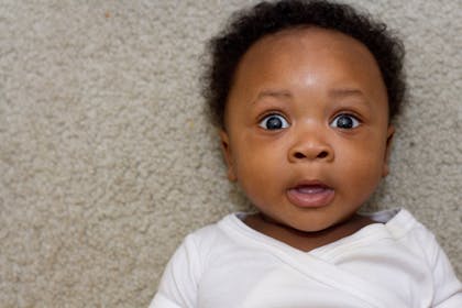 baby with surprised look on their face