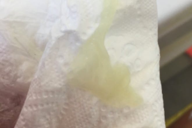 Yellow discharge with no smell Yellow discharge with no smell