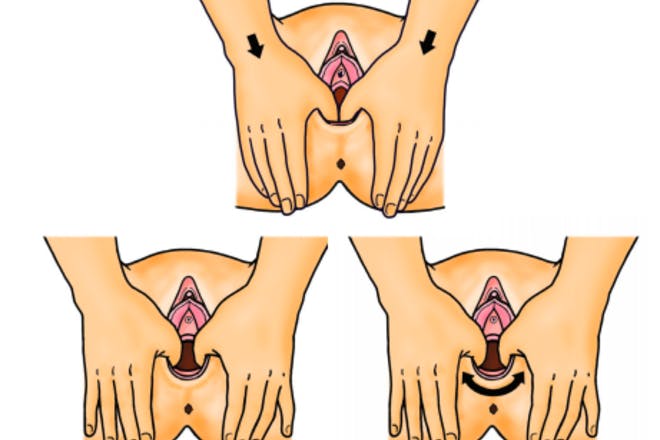 Illustration showing techniques for perineal massage