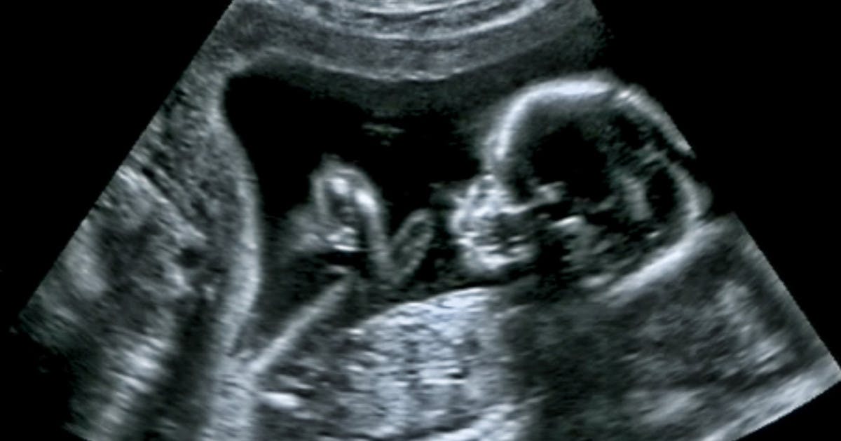 Skull Theory: Can It Predict If Having A Boy Or A And How Does It Work? - Netmums