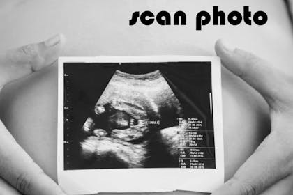 ultrasound scan