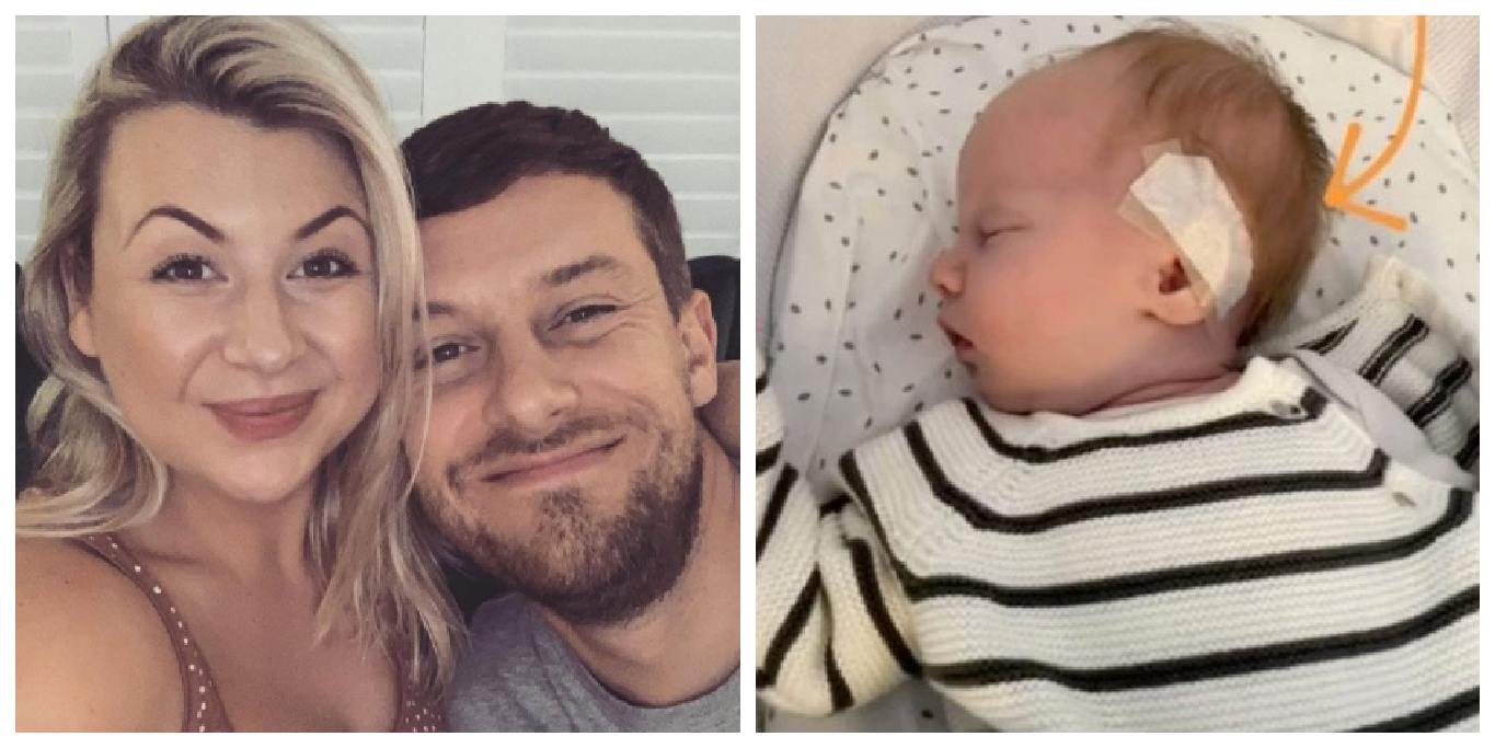 chris and rosie ramsey s baby has treatment on pointed ears netmums